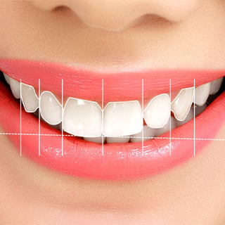Prosthetic Dental Treatments