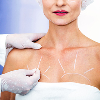 Breast Lift-Lifting (Mastopexy) Aesthetics