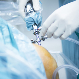 Arthroscopic Surgery