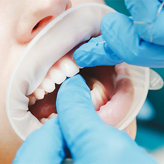 Oral, Dental, Maxillofacial Surgery