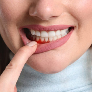 Periodontology (Gum Treatments)